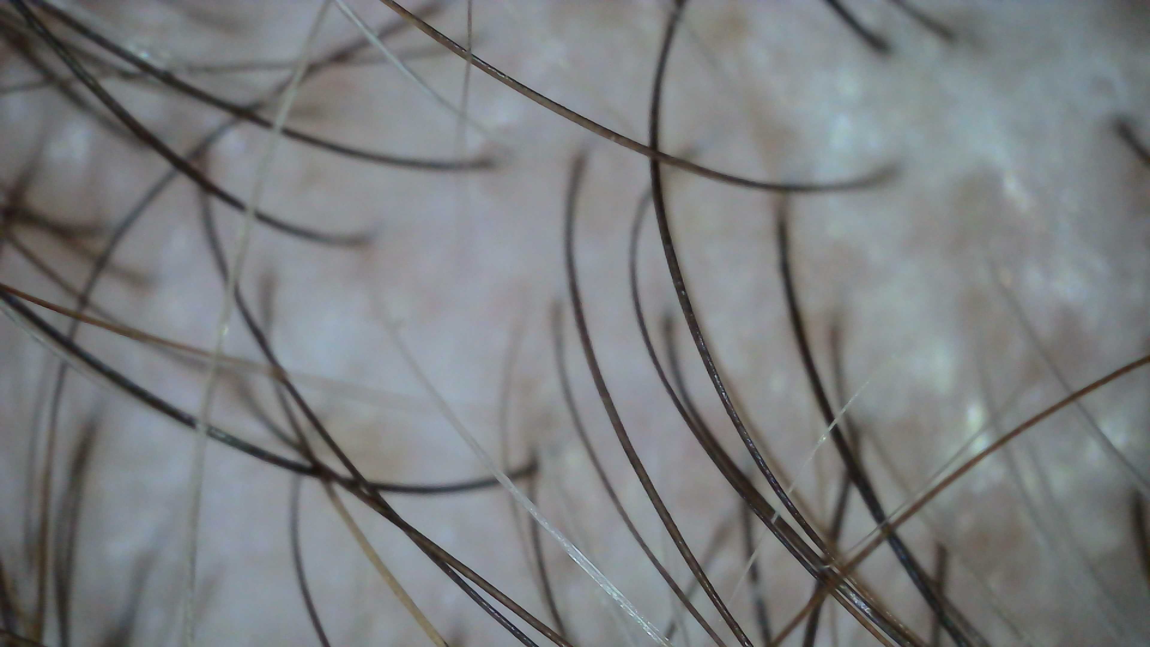 Magnified Hair Follicle
